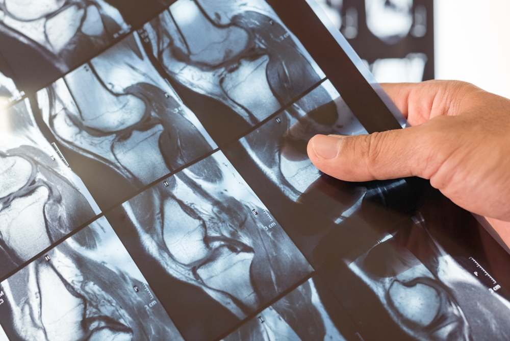 Separating Circulation From Structural Changes